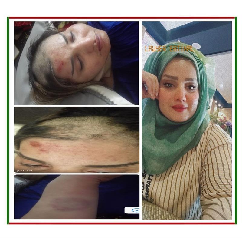 خلاف على الإرث يتسبب بضرب محامية وحلاقة شعر رأسها في بغداد (صور)