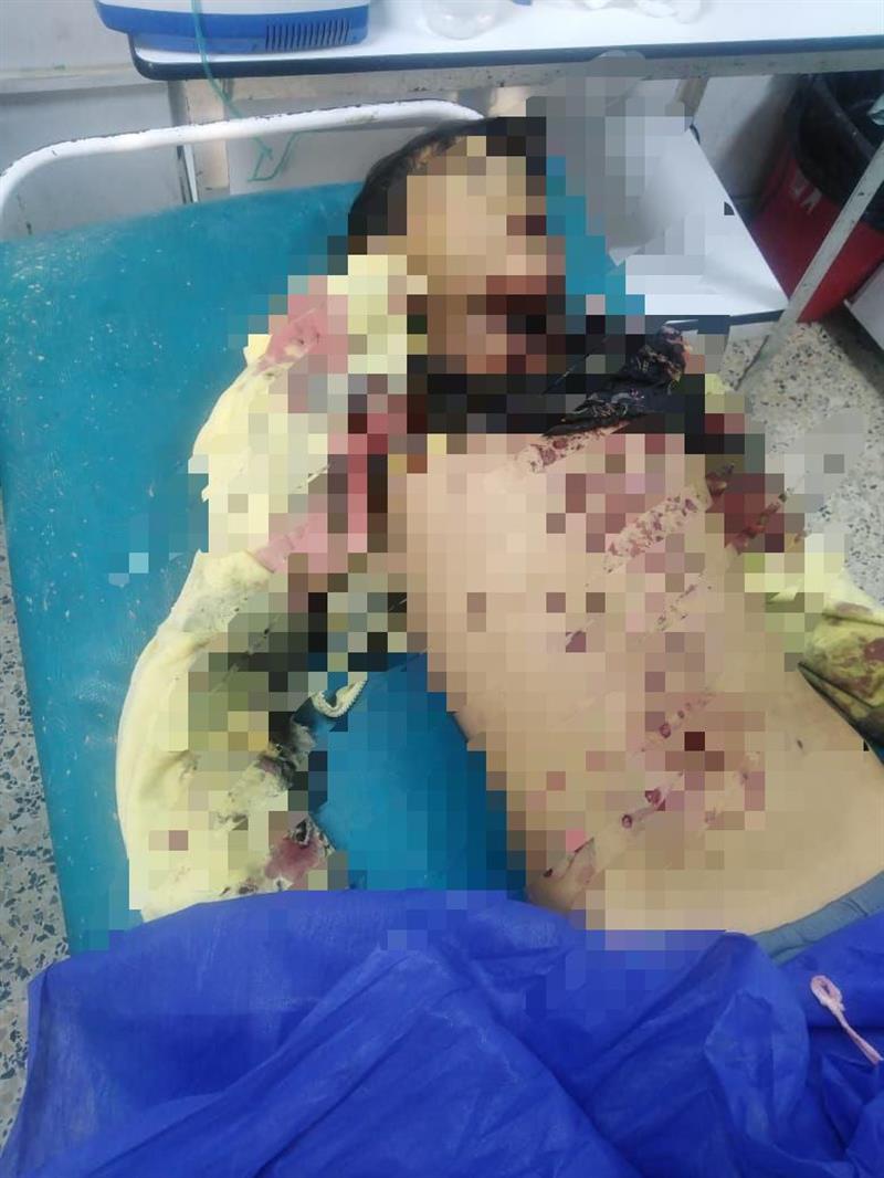 قنبلة يدوية تنهي حياة طالب مدرسة أثناء عبثه بها شرقي بغداد (صور)